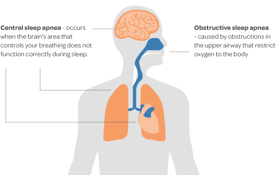 Sleep Apnea Scoring Chart